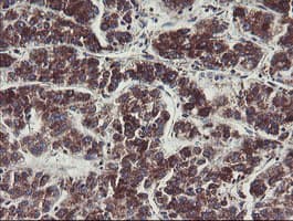 Monoclonal Mouse anti-Human C1orf151 Antibody (clone 4H7, Carrier-free, IHC, WB)