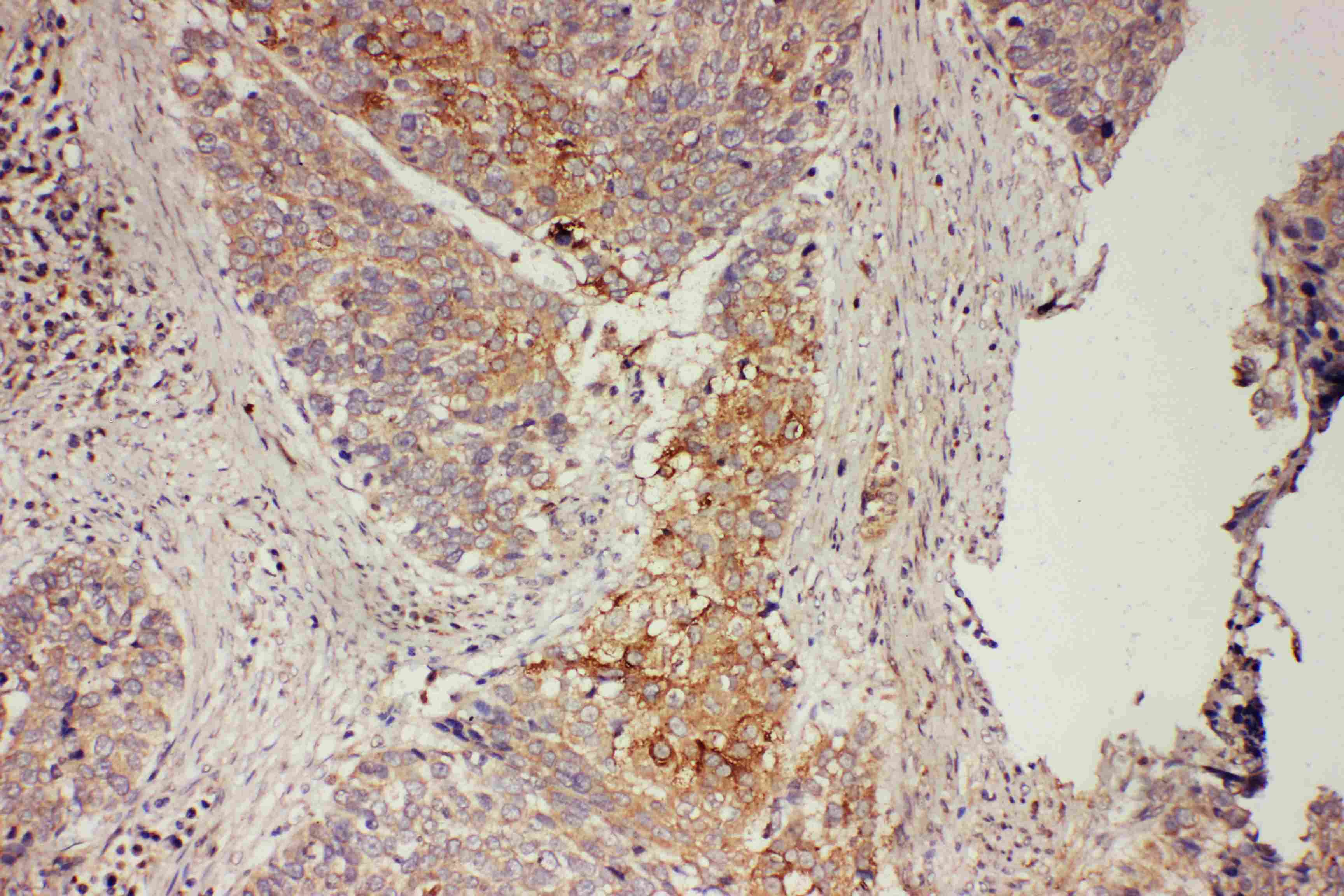 Polyclonal Rabbit anti-Human GRB7 Antibody (aa176-192, IHC, WB)
