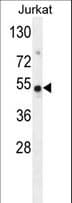 Polyclonal Rabbit anti-Human FAM118B Antibody (aa212-240, WB)
