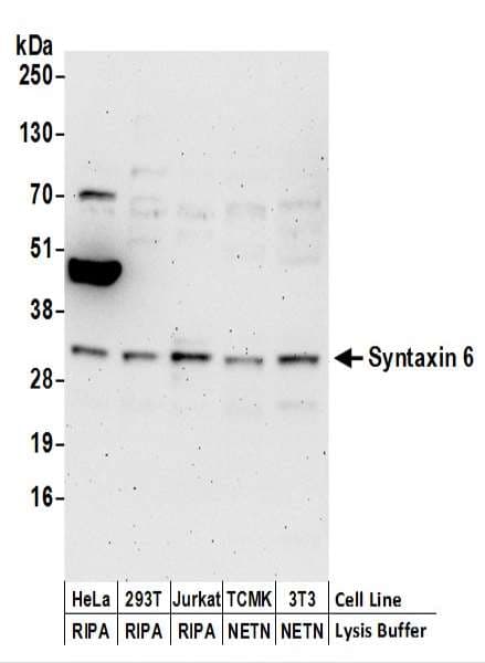 IHC-plus™ STX6 / Syntaxin 6 Antibody (aa75-125)