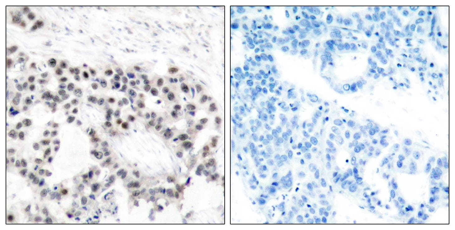ER Alpha / Estrogen Receptor Antibody (phospho-Ser106)