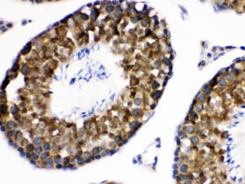 WNK1 Antibody