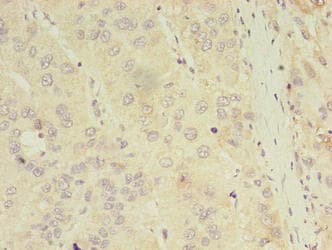 Polyclonal Rabbit anti-Human ASB11 Antibody (IHC)