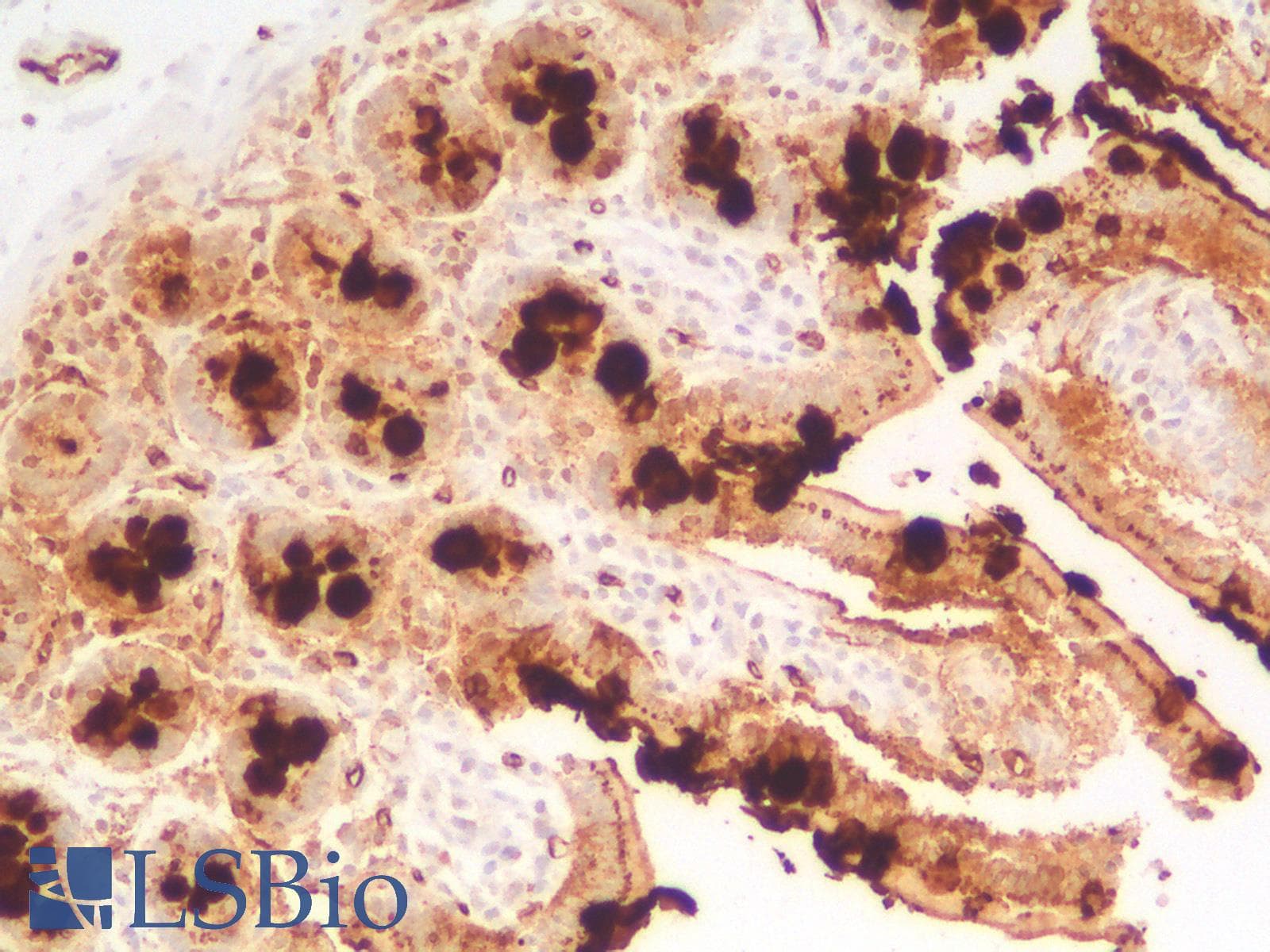 PathPlus™ TAG-72 Antibody (Concentrated)