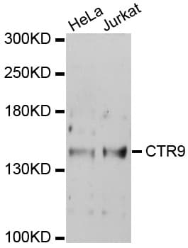 CTR9 Antibody