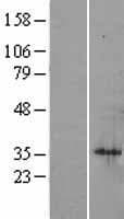 SIAH1 Protein (Over-Expression Lysate Myc-DDK (Flag))