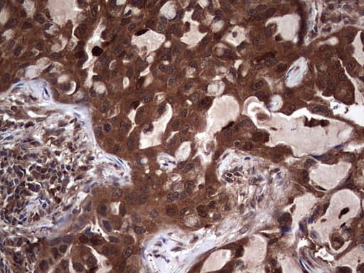 LGALS3 / Galectin 3 Antibody (clone OTI7G9)