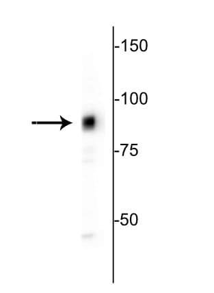 Polyclonal Chicken anti-Human MARCKS Antibody (IHC, IF, WB)