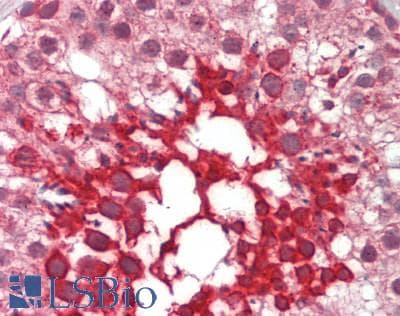 IHC-plus™ Polyclonal Rabbit anti-Human NOXO1 Antibody (C-Terminus, IHC, WB)