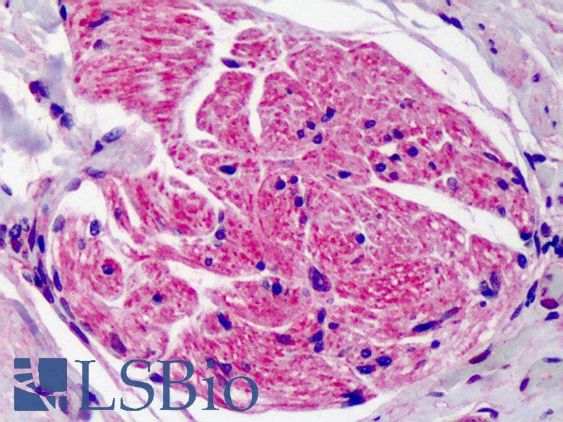 IHC-plus™ SUMO2 + SUMO3 Antibody (aa49-81)