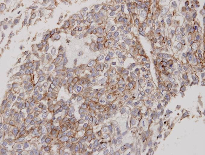 FLOT2 / Flotillin 2 Antibody (aa365-428)