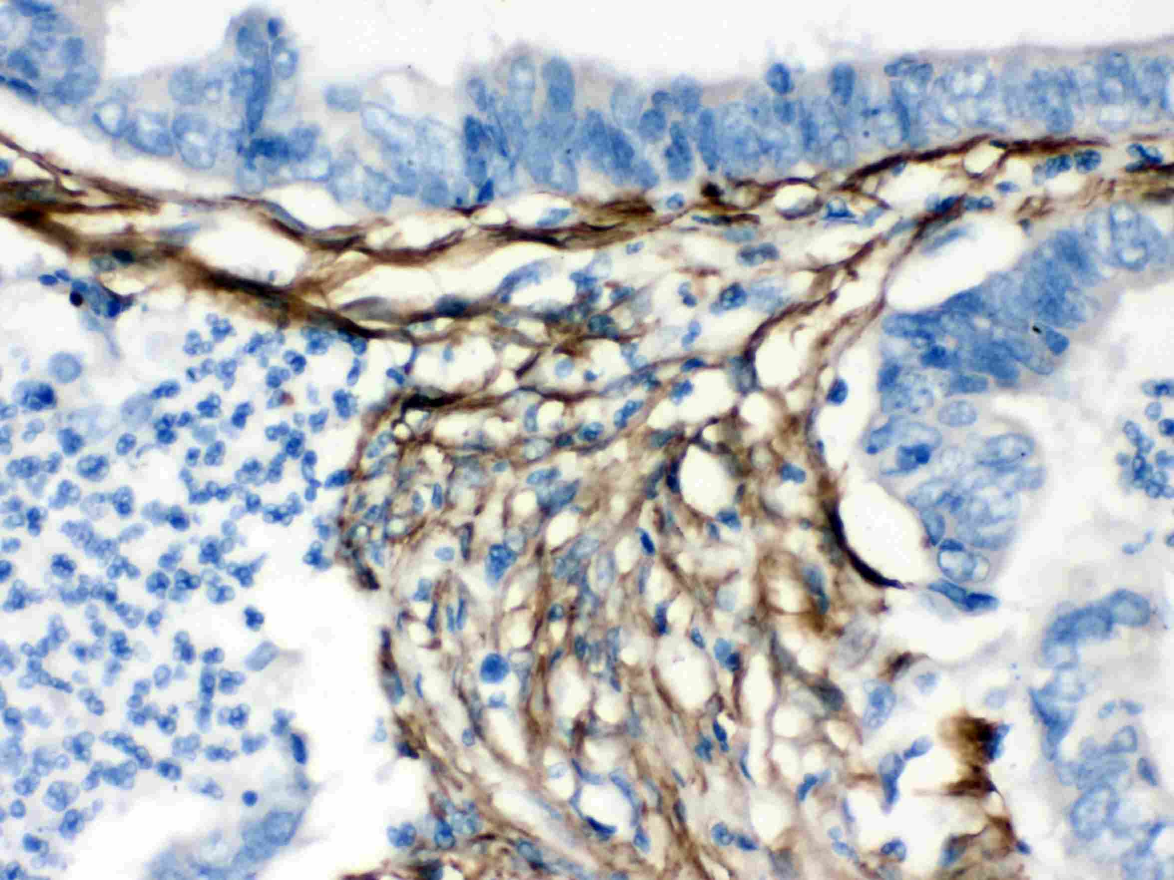 CALD1 / Caldesmon Antibody