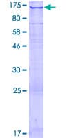 Human WDR66 Protein (Recombinant GST)