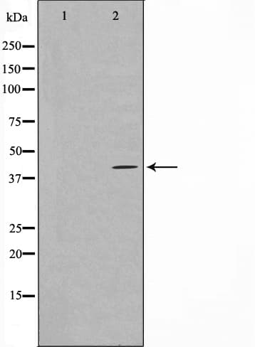 HTR5A / 5-HT5A Receptor Antibody
