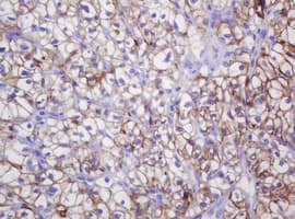 Monoclonal Mouse anti-Human CA12 / Carbonic Anhydrase XII Antibody (clone OTI2C6, IHC, WB)