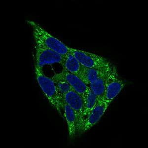 IHC-plus™ PRKAG1 / AMPK Gamma 1 Antibody (aa230-331, clone 7H3E9)
