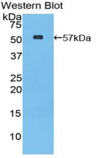 GZMM / Granzyme M Antibody (aa31-257)