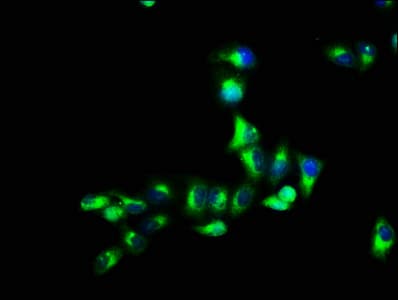 Polyclonal Rabbit anti-Human GPR12 Antibody (IHC, WB)