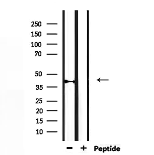 Polyclonal Rabbit anti-Human CYP27C1 Antibody (IHC, WB)