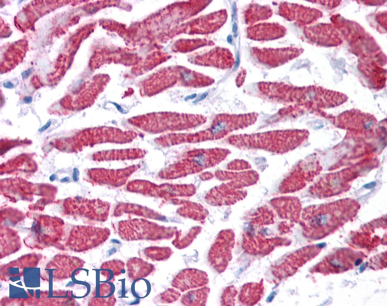 GPX4 / MCSP Antibody (aa72-121)