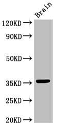 Polyclonal Rabbit anti-Human MNAT1 Antibody (IHC, WB)