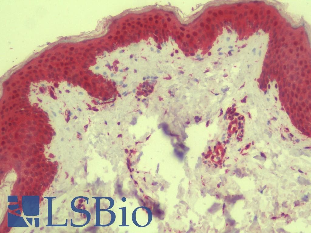 IHC-plus™ TMPRSS11A Antibody