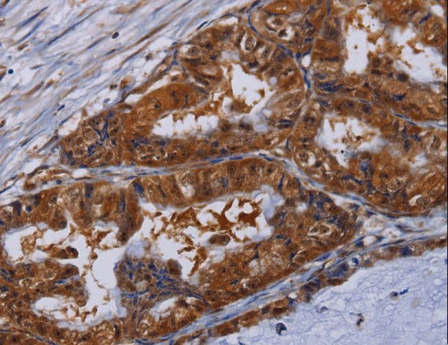 MFAP3L / NYD-Sp9 Antibody