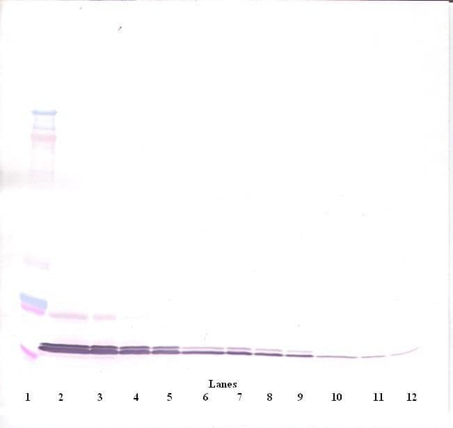 IHC-plus™ Polyclonal Rabbit anti-Human CXCL11 Antibody (IHC, WB)