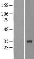 FAM54B Protein (Over-Expression Lysate Myc-DDK (Flag))