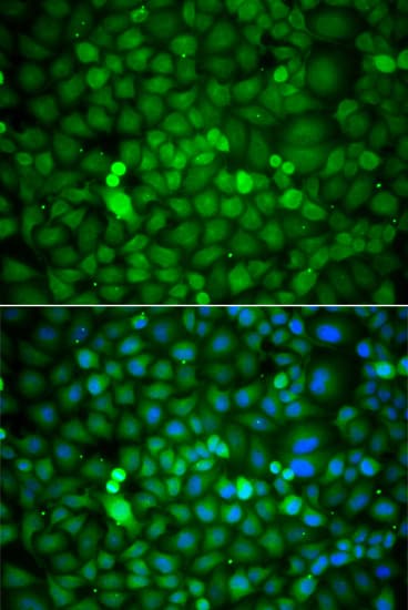 HDAC7 Antibody