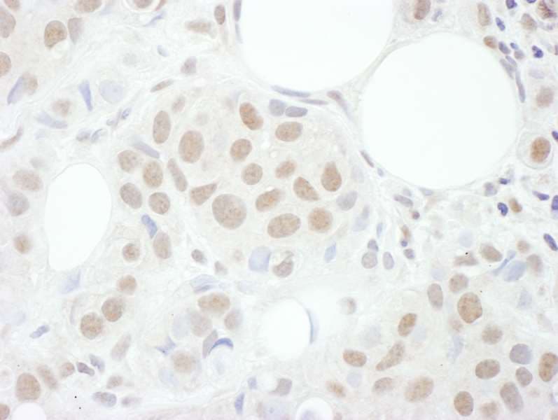 CCNT1 / Cyclin T1 Antibody (aa325-375)