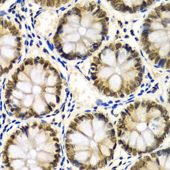 SNRPE Antibody