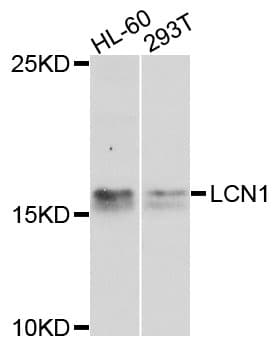 LCN1 / Lipocalin-1 Antibody