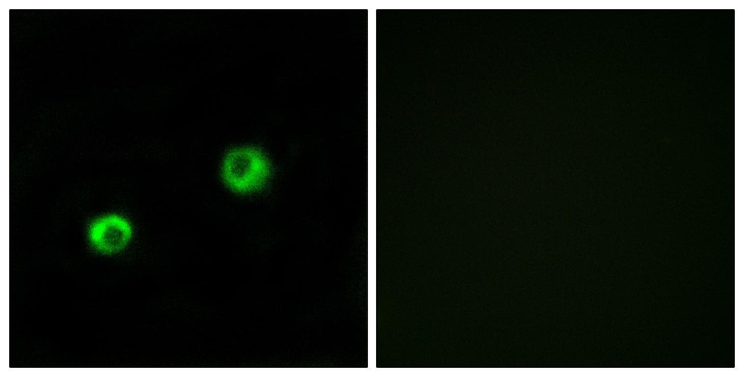 Polyclonal Rabbit anti-Human ARSI / Arylsulfatase I Antibody (IF, WB)