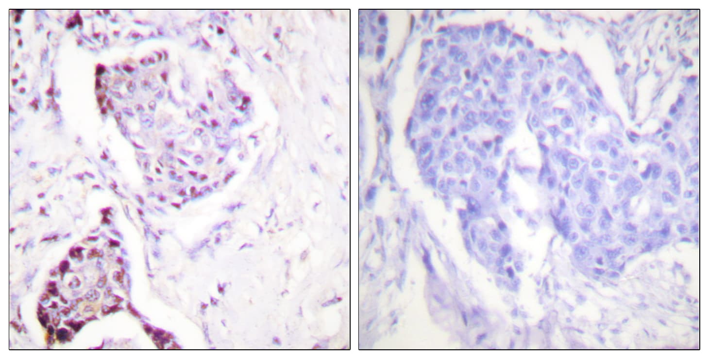 Ubiquitin Antibody