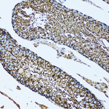 Polyclonal Rabbit anti-Human NOL3 / ARC Antibody (IHC, IF, WB)