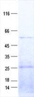 Human PLA2G3 Protein (Recombinant His, N-Terminal)