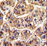 Polyclonal Rabbit anti-Human IFNAR1 / IFNAR Antibody (aa162-188, IHC, WB)