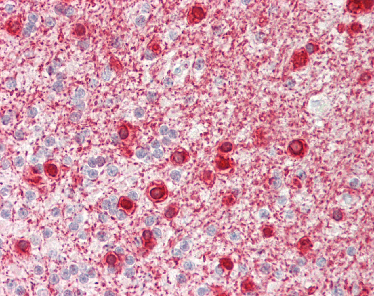 IHC-plus™ TERE1 / UBIAD1 Antibody