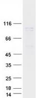 Human TFIP11 Protein (Recombinant Myc-DDK (Flag))