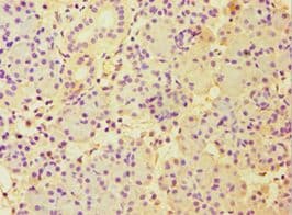CBLC Antibody (aa245-474)