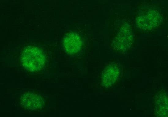 ANKRD49 Antibody (clone OTI3E4)