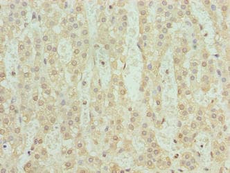 SERTAD1 / TRIP-Br1 / SEI-1 Antibody