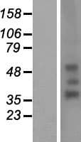 RHD Protein (Over-Expression Lysate Myc-DDK (Flag))