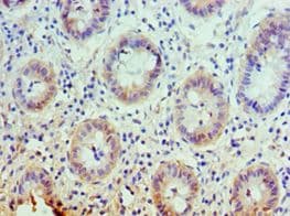 SLC25A13 / CITRIN Antibody (aa1-300)