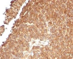 TOP1MT Antibody (clone TPIMT-1)