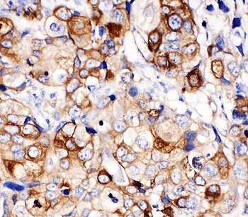 HSPB1 / HSP27 Antibody