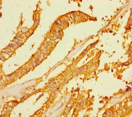 FAM167A Antibody