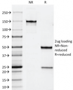 Monoclonal Mouse anti-Human ERBB2 / HER2 Antibody (clone HRB2/258, Azide-free,BSA-free, IHC, IF)