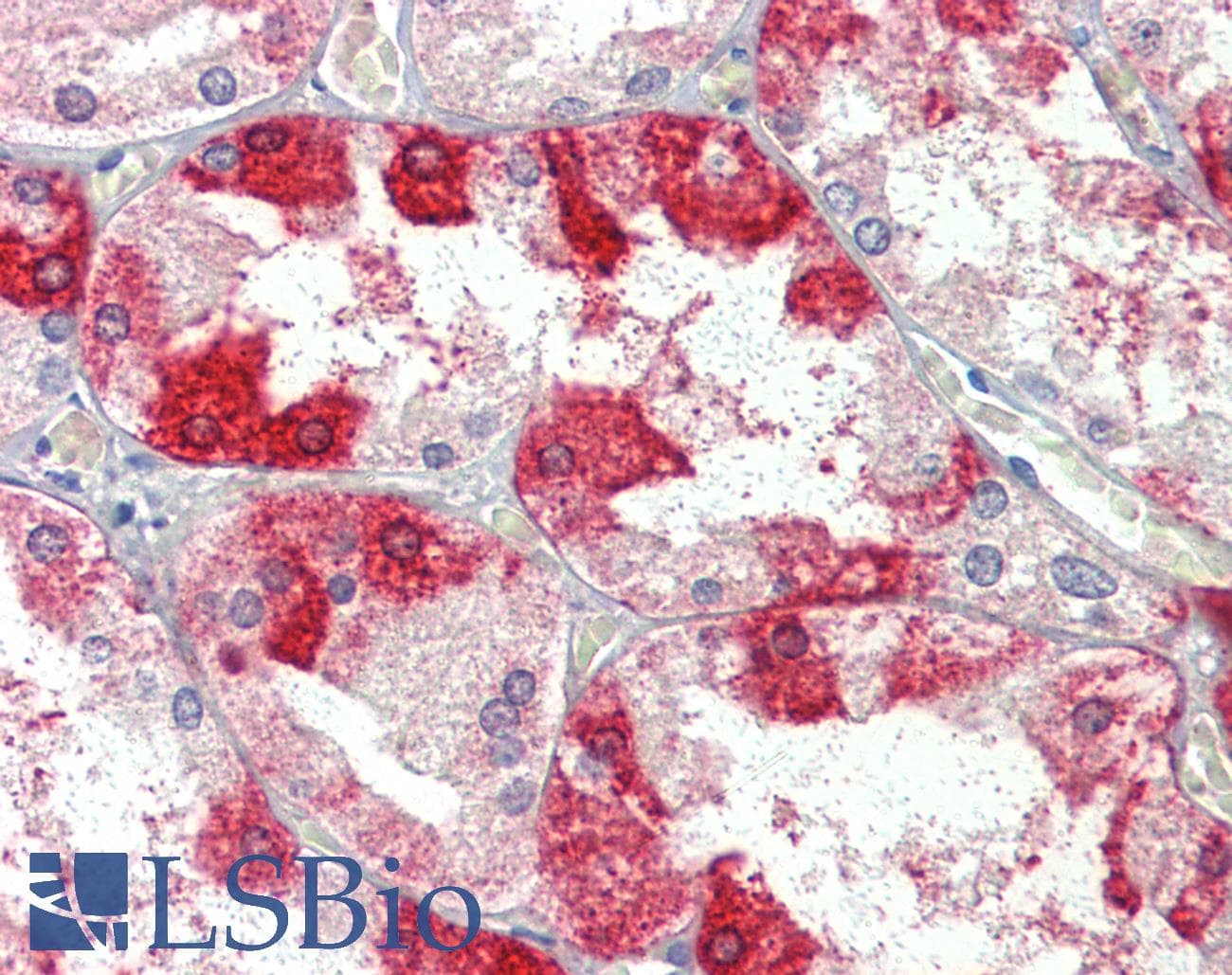 IHC-plus™ Polyclonal Goat anti-Human CLTC / Clathrin Heavy Chain Antibody (aa1617-1630, IHC)